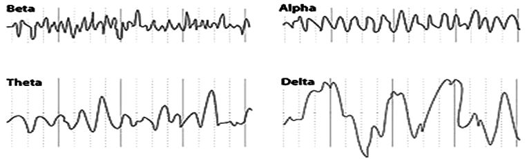 Příklad EEG signál