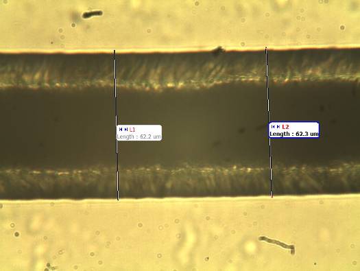 Obr. 13. Psí srst – objektiv 40× (naměřené hodnoty 62,2; 62,3 µm).