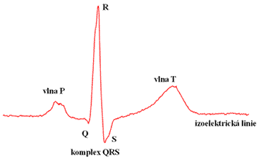 Obr. 3. Popis EKG křivky.